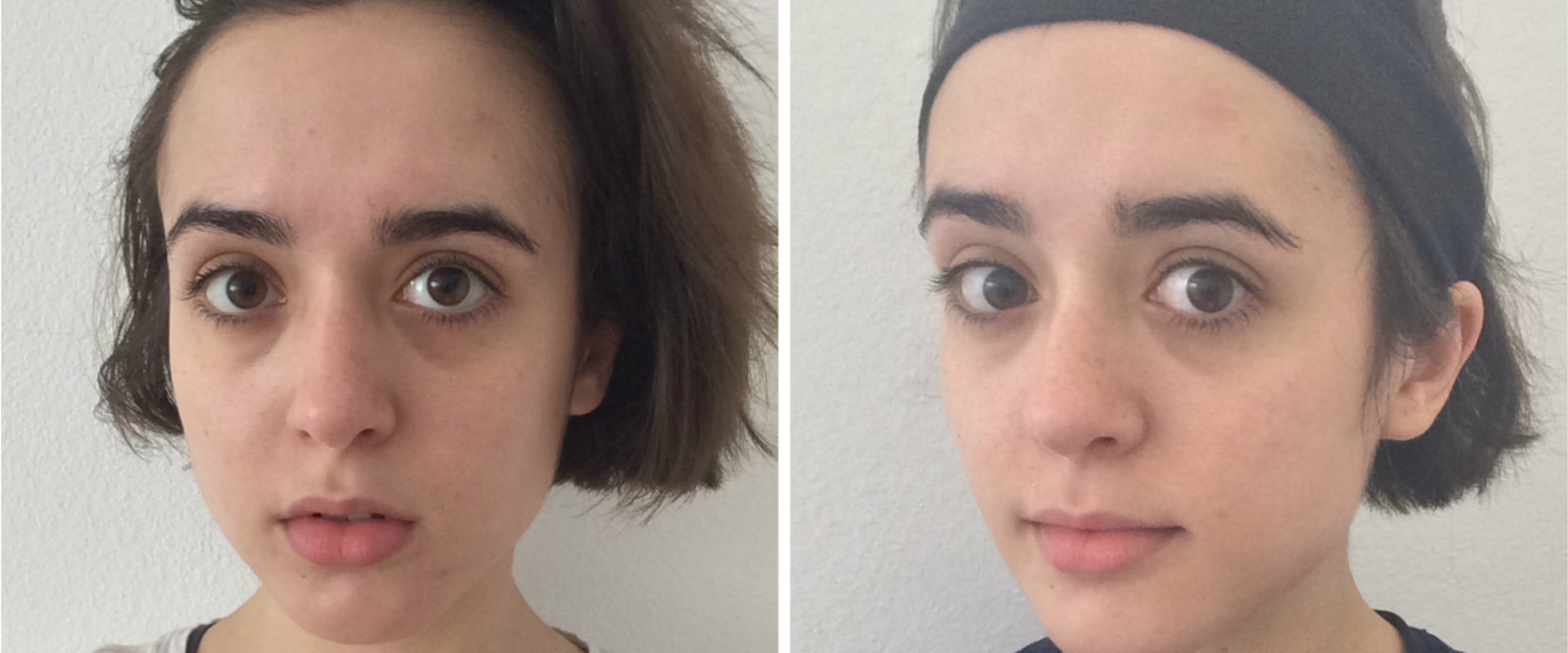 Can Coffee be Used for Skin Care?