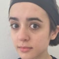 Does Coffee Darken the Skin? - An Expert's Perspective