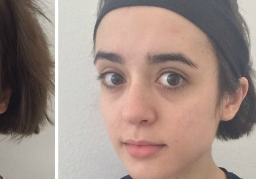 Does Coffee Darken the Skin? - An Expert's Perspective